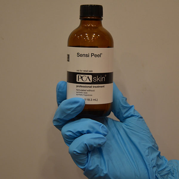 chemical peel